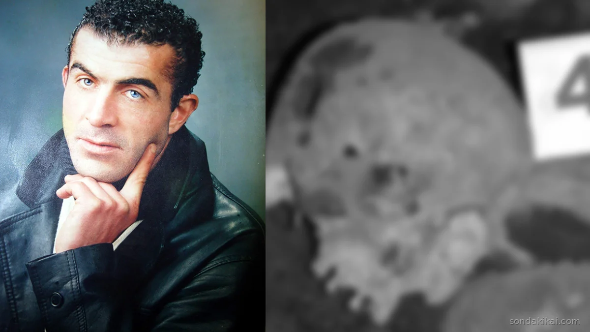 Zonguldak'ın 16 Yıllık Sırrı Çözüldü: Barajdan Çıkan Kemikler Konuştu